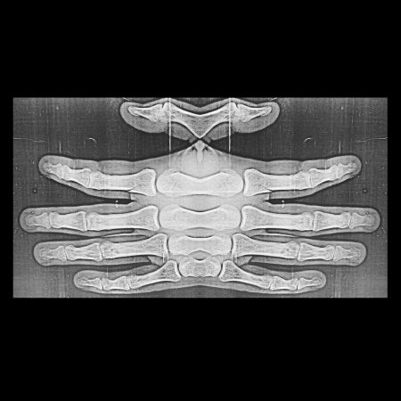 "Tanzender Besofenner Kryptogen Rindfunk" remixes compilation